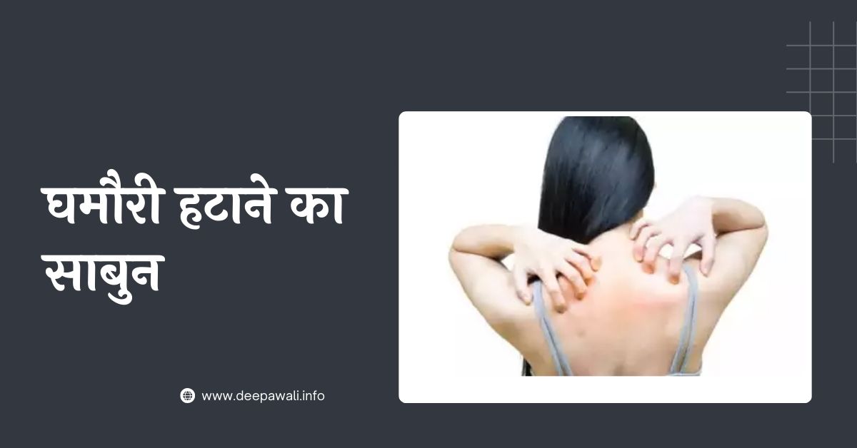 घमौरी हटाने का साबुन - Ghamoriya Hatane Ka Sabun